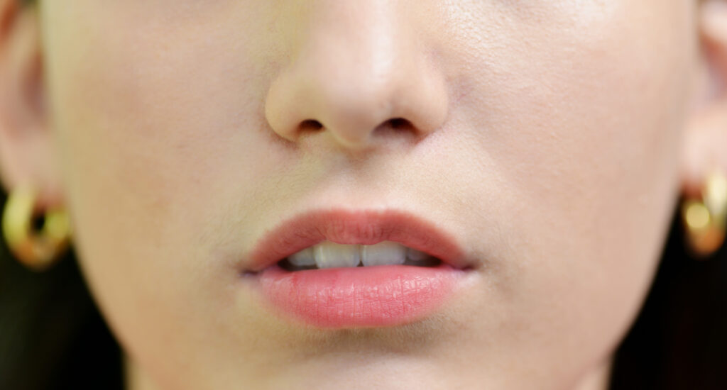 青森県三沢市　歯医者　小児　口　ポカン