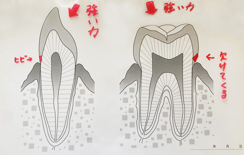 青森県三沢市よしだ歯科医院(歯医者)では歯科技工士・歯科受け付け・歯科衛生士さんの求人募集(リクルート 正社員・パート)募集中です